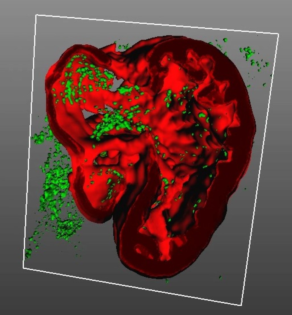 MICROSCOPIA OPTICA DE FLUORESCENCIA